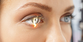 Komplexe Augen-Operationen in unserer Praxis